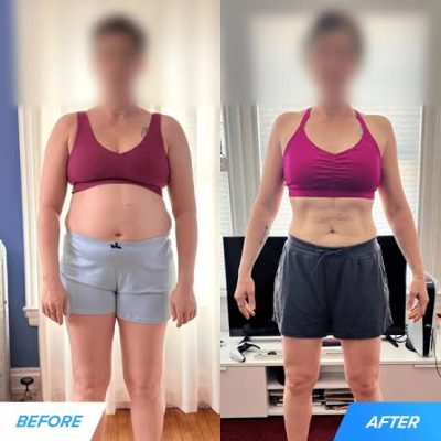 Reta Weight Loss: Understanding Retatrutide Dosage Per Week Reta